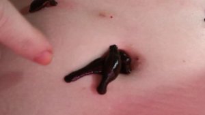 ASMR/пиявки на пупок/ leeches on the navel /