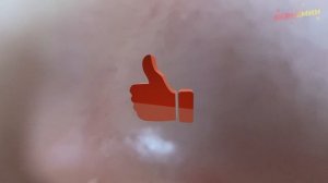 РАСШИРЕННЫЕ ПОРЫ. КАК УБРАТЬ НАВСЕГДА? ЛЕГКО!