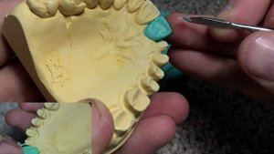 Моделировка зубов. Как моделировать центральный резец? Серия видео моделировки верхних зубов.