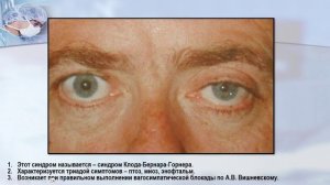 Ситуационная задача на тему: "Шея"