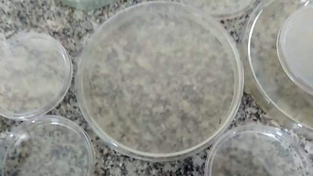 Robert Koch using Petri dish to today using Petri plates collections смотреть онлайн