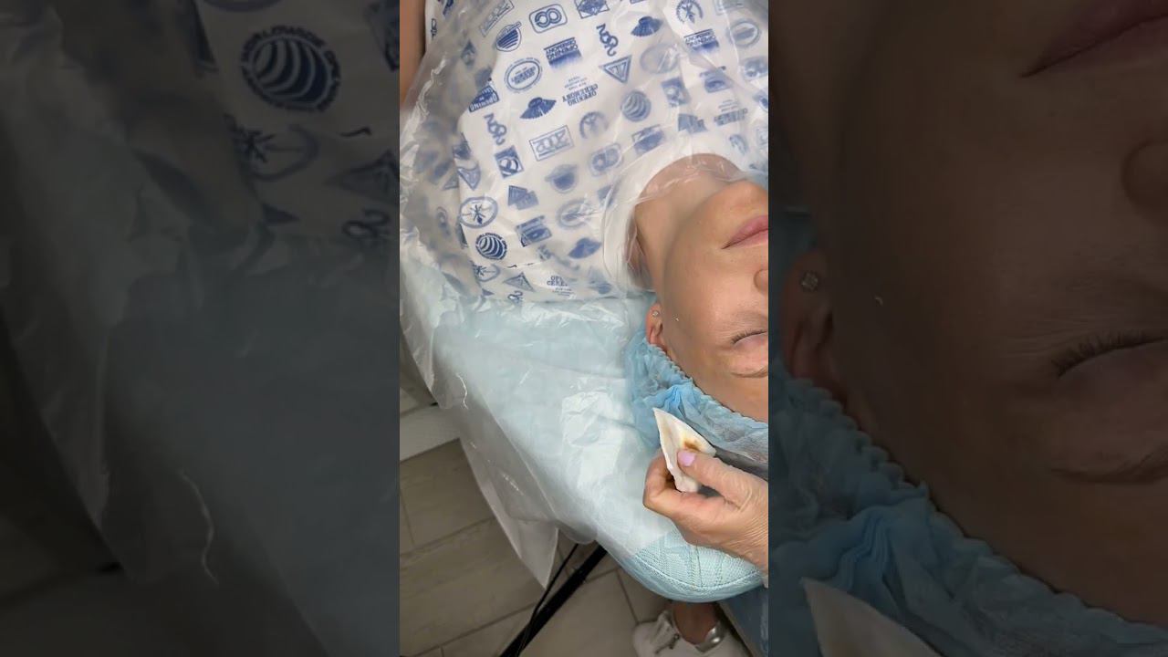 БРОВИ ТАТУАЖ ГИПЕРРЕАЛИЗМ  МЕТОД ВОЛОСКИ АЛОПЕЦИЯ  ПЕРЕСАДКА БРОВЕЙ ПЕРМАНЕНТНЫЙ МАКИЯЖ #shorts