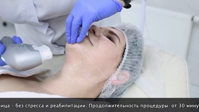 SMAS ЛИФТИНГ УЛЬТРАФОРМЕР. КЛИНИКА LITO MEDICAL.