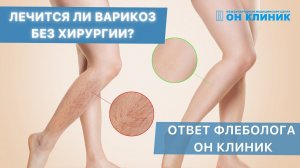 Лечится ли варикоз без хирургии? Ответ флеболога ОН КЛИНИК