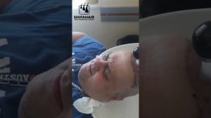 Мытье головы после пересадки волос на 3 день