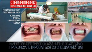 лечение зубов в Китае stomadentchina.ru