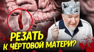 Аппендикс удалять не надо? Язву отобрали у хирургов? | Алексей Водовозов | ДНЗ 2-5