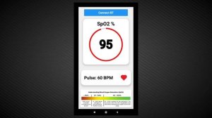 Max 30102 and ESP 32 pulse oximeter with android app