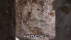 Как очистить организм и избавиться от отеков с помощью льна