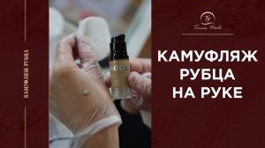 Камуфляж рубца на руке. Мастер Татьяна Фенева