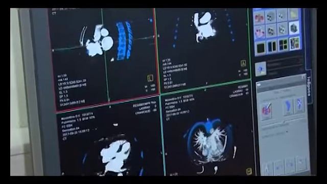 29 сентября - Всемирный день сердца смотреть онлайн