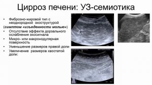 Цирроз печени