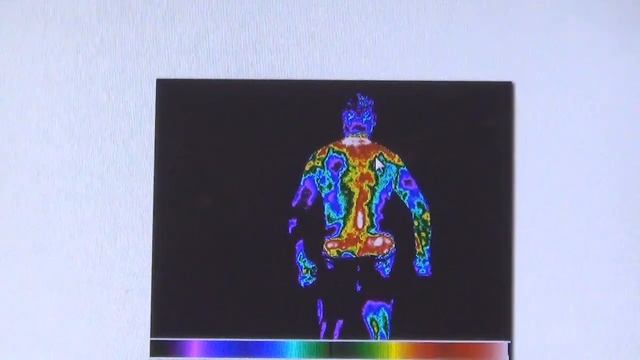 Как тепловизор помогает выявить причинно следственные связи и установить диагноз в медицине. смотреть онлайн