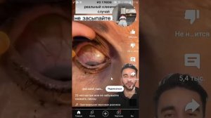 Короче говоря смотрю новогодние шорты