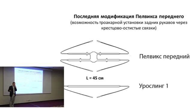 Лекция по профилактике осложнений в хирургии пролапса тазовых органов и недержания мочи