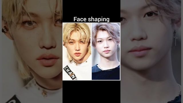 Felix STRAY KIDS PLASTIC SURGERY?? ? #kpop #straykids #felix