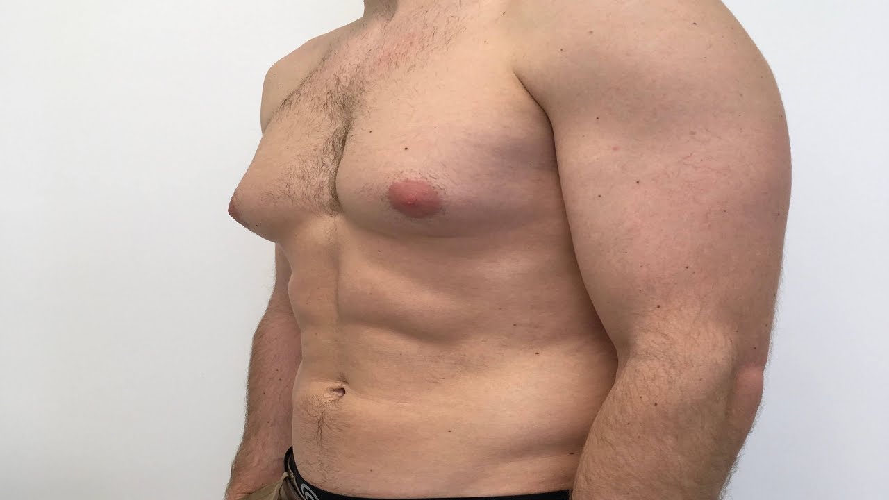 красное уплотнение на груди у мужчин фото 72
