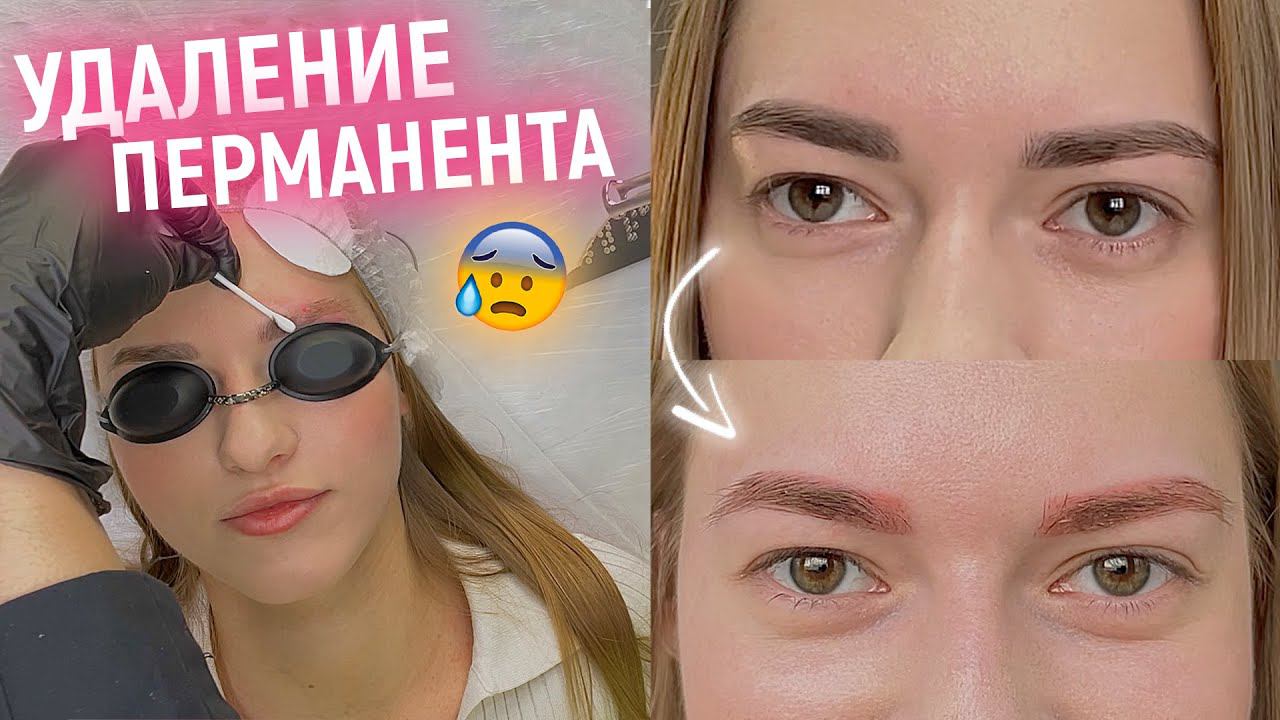 ЛАЗЕРНОЕ УДАЛЕНИЕ ПЕРМАНЕНТА БРОВЕЙ ⭐️ инверсия цвета, результат от 2х процедур