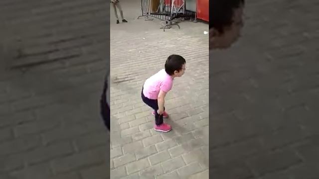 Собака укусила девочку очень сильно!