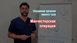 Манчестерская операция. Делать или нет?