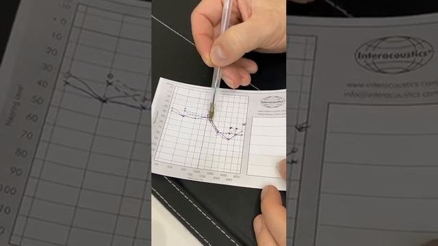 Расшифровка аудиограммы