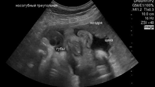 Беременность 31-32 неделя. Малыш жуёт в животе у мамы.
