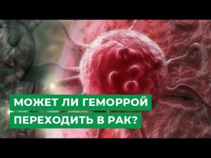 Может ли геморрой переходить в рак?