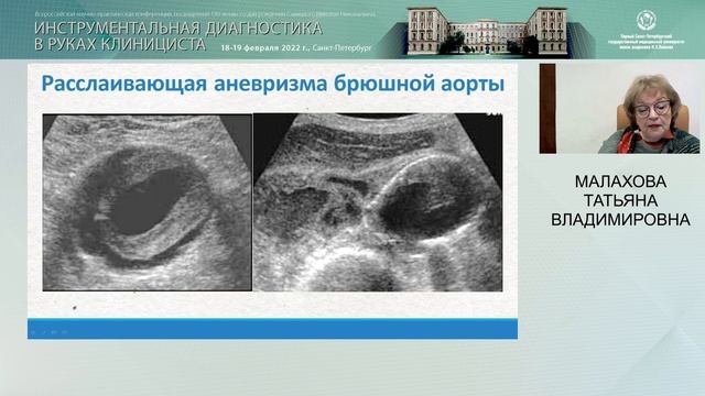 Ультразвуковое исследование в ургентных ситуациях у постели больного: на что нужно обратить внимани