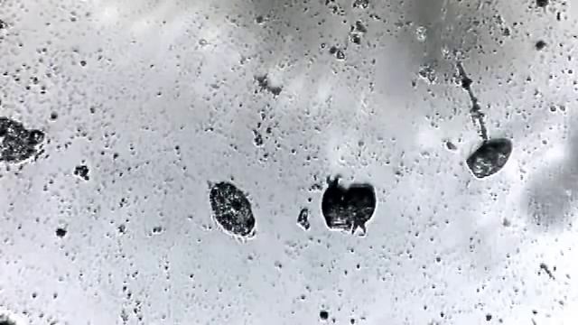 микробы под микроскопом, редкое зрелище!