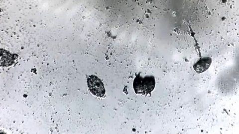 микробы под микроскопом, редкое зрелище!