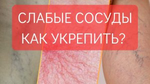 ХРУПКИЕ  И СЛАБЫЕ СОСУДЫ. КАК УКРЕПИТЬ?