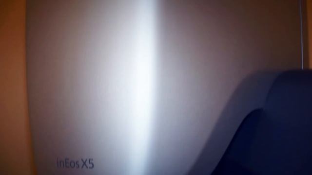 Протезирование на имплантатах | СЦ «Дентика» смотреть онлайн