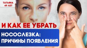 НОСОСЛЕЗКА: причины появления и как ее убрать