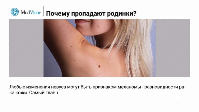 Почему пропадают родинки? смотреть онлайн