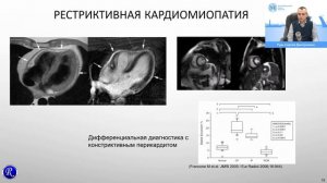 Лучевые методы визуализации в диагностических алгоритмах острой и хронической СН