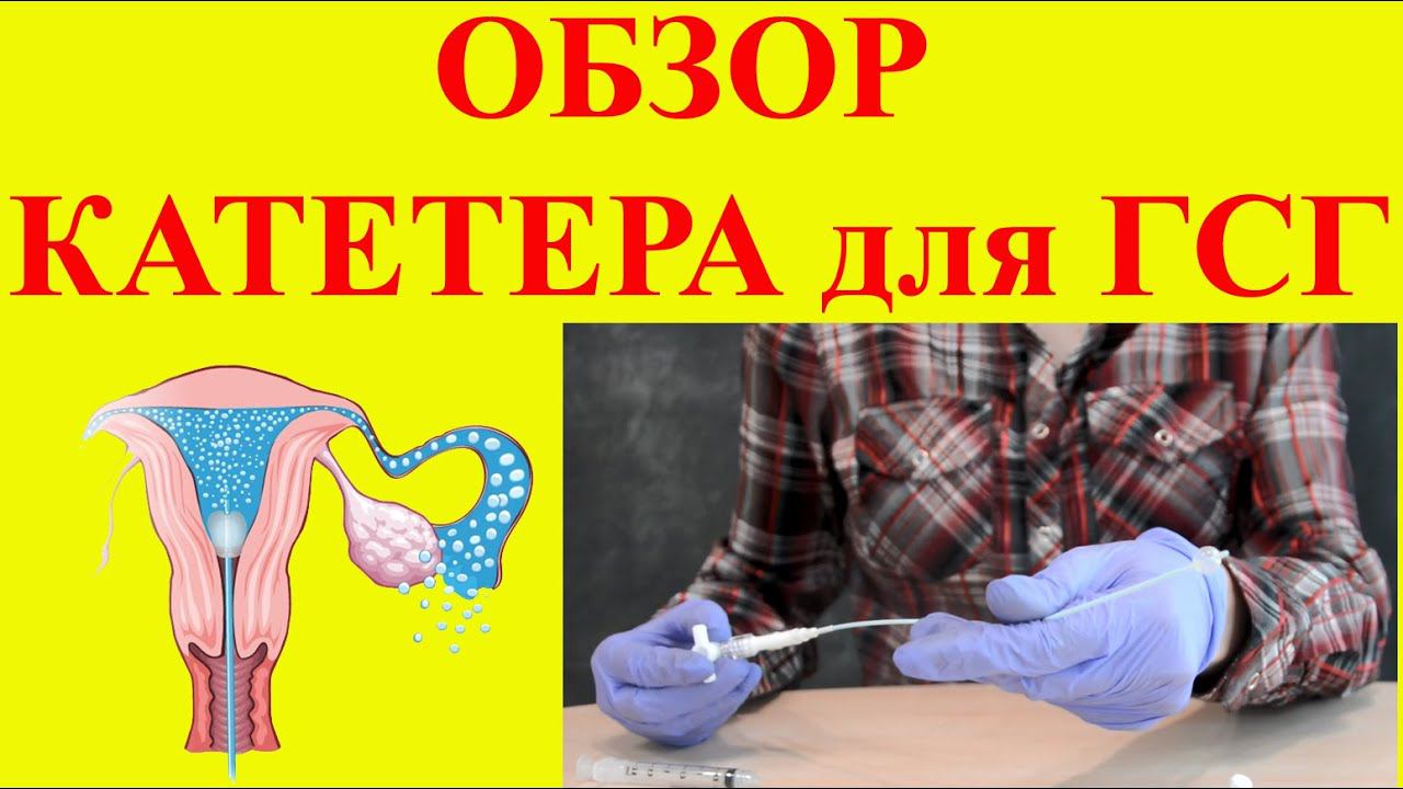 Обзор катетера для ГСГ (гистеросальпингографии)