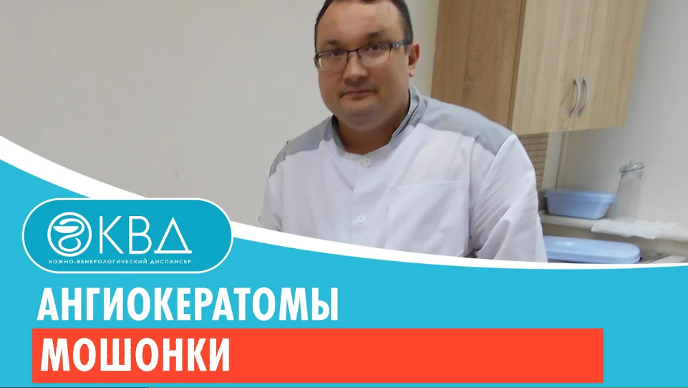 ?♂️ Ангиокератомы мошонки Клинический случай №428