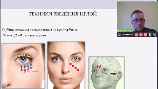 Периорбитальная область. Вебинар