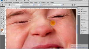 Photoshop 2.34 Устранение веснушек и прыщей. Антон Мякотин.