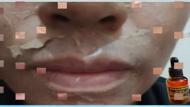 HIDRODERMA: PEELING sin dolor con excelentes resultados en tres días. смотреть онлайн