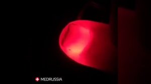 Капиллярный пульс