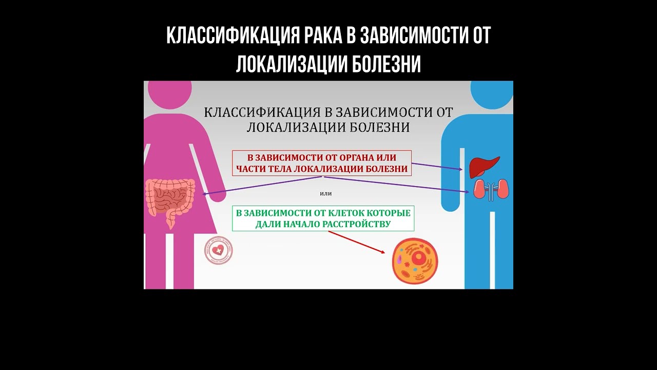 Классификация рака в зависимости от локализации болезни смотреть онлайн
