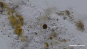 Ameba Polychaos dubium - Amoeba Polychaos dubium