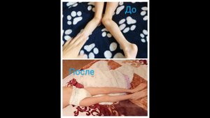 Данил 1 месяц приема при ДЦП: После инсульта, Нервная система, Очищающий - Эволюция Природы