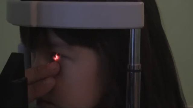 разметка оси положения ИОЛ смотреть онлайн