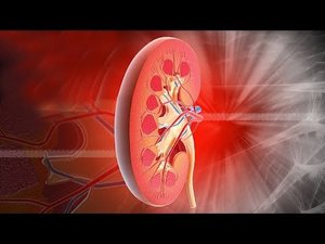 Проект «Искусственная почка» | Просто о сложном