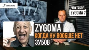 Скуловая имплантация зубов Zygoma Зигома → при полном отсутствии зубов и костной ткани #zygoma