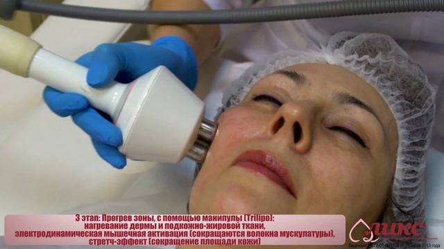 rf лифтинг смотреть онлайн