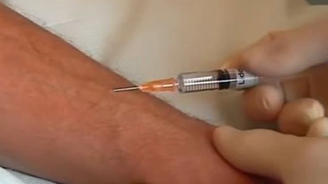 Внутрикожная инъекция.