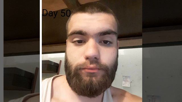 Рост бороды по дням, 100 дней /Beard growth by day, 100 days